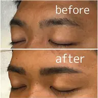 【眉癖改善】ハリウッドブロウリフト