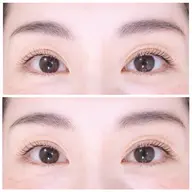 ラッシュリフト(上のみ)🥥