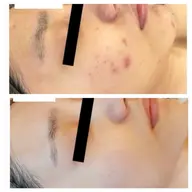 【初回限定】オルちゃん肌に憧れる方へ！目指せ陶器肌プログラム体験