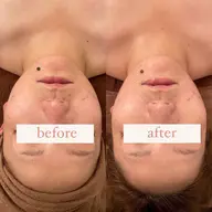 【非対称コルギ80分】硬い顔がスッキリ解消！歪み食いしばりの方おすすめ...！