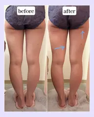 【期間限定モニター】💎ラジオ波×キャビテーション痩身💎（60分）