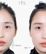 【新HBL】毛流れ改善で自然で扱いやすい眉へ ¥3,900→¥3,000
