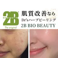 【2B BIOハーブピーリング】肌を土台からの改善◎深いシミ、シワ、ニキビ、毛穴の開きなどの根本的な肌悩みにアプローチ！