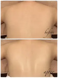 ⭐️ミニモ限定 背中オイルマッサージ付き⭐️脱離なし★背中ピーリング&美白パック 背面美人コース50分 ¥5500