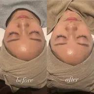 【肌質改善】クリスティーナ ビオフィートシリーズ ハーブピーリング🌿