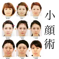 人数限定★ミニモ限定👑初回体験+2回施術の3回券!残り4名