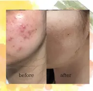 元祖グリーンピール