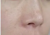 【毛穴レス肌育フェイシャル】