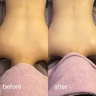 陶肌トリートメント　ハーブピーリング🌿お背中