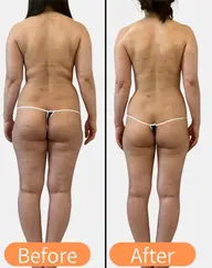 【メリハリ美ボディに◉】キャビテーション&ラジオ波&EMS &発汗デトックス90分