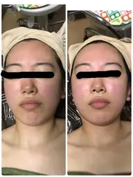 minimo限定✨口コミ＆写真撮影クーポン✨写真の目は消します😌