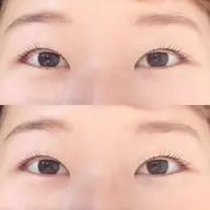 ぱっちり～パリジェンヌ★　ヒアルロン酸アイシート＆美容コーティング付き