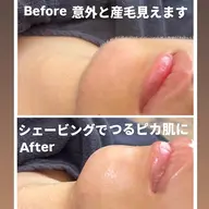 レディースシェービング