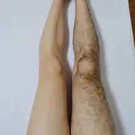 【毛穴までキレイに！】ひざ下脱毛￥7700