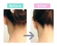 【結婚式&イベントうなじスッキリ】シェービング脱毛!予約日下記注意事項有!【挙式日など】1日~2日前迄にご予約厳守です!