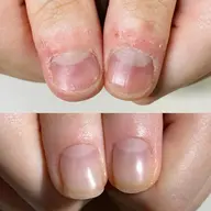 自爪育成ジェル オイル1本プレゼント ジェルを使用して爪を縦長へ導きます。白い部分ばかり伸びる方、2枚爪で割れる方など