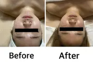 大人気！顔も体もスッキリ♪小顔コルギ60分＋ボディーオイルリンパマッサージ上半身or足30分＋パック付き（計90分）