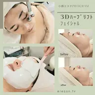 《エイジングケアにも◎小顔ケアでリフトアップが叶う☆》速攻小顔&潤つや肌フェイシャル60分　[大阪城北詰駅/京橋駅]