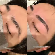 ハリウッドブロウリフト