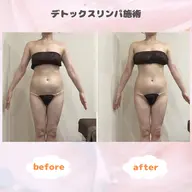 【部位別ダイエットに◎】選べる上or下半身×2回✨デトックスリンパ&最新ラジオ波🔥老廃物ドバドバ温活ダイエット🔥
