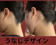 【女性脱毛】実はみられてるあ！うなじ&背中似合わせシェービング付き