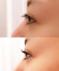 くるりんまつげパーマ