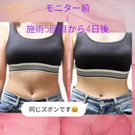 初回限定✨️痩身クリーム付🔥テスラシェイプ1箇所30分＆痩身クリーム9350円