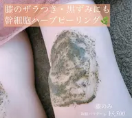 本気で肌荒れを治したい方にオススメ❣️剥けない幹細胞ハーブピーリング【膝】1g