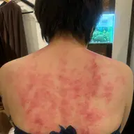 オリジナル刮痧　オールかっさコース　(かっさのみ　全身　 約90分、足湯付き)
