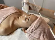 ダーマスタンプ+へその緒幹細胞培養液