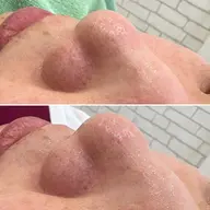 🕊‎毛穴ケア🌿