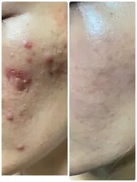 お悩み別フェイシャル✩￥22,000→￥20,000