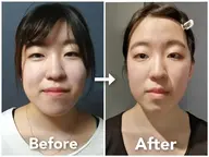 ✨学割U24✨1度でも驚きの効果❗️整体/エラ張り/肩こり/目の大きさ/眉の高さ【小顔矯正+首肩矯正+頭蓋骨矯正】60分