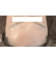 小顔矯正と最高級プラセンタ、ヒアルロン導入コースで憧れの小顔と美肌に導きます！デコルテ背面マッサージ付き