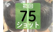 【初回価格】シワ・シミ・くすみ・たるみなどお顔全般のケアに 75ショット