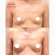 【本気の育乳‼️】全身マッサージで一回でふわふわ感動バスト✨️下垂/ボリューム/産後/左右差