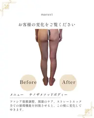 chino themethod(チノザメソッド)美骨矯正ボディーコース