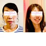 超美肌！！DX美肌フェイシャル