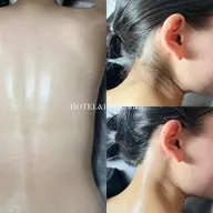 3/31限定🍓【背中ALL(うなじ込)ワックス脱毛】*鎮静パック付