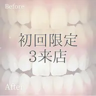 【ミニモ限定✨】3来店チケット通常¥20,940→¥12,000👀ホワイトニングの良さを知ってください❗️