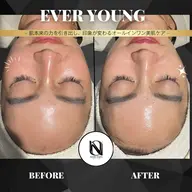 【✨1回で肌印象UP】EVER YOUNG｜うるおい・ハリ・毛穴ケアをまとめてサポート〈メンズOK〉