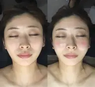 緊急🚨当日限定ミニモクーポン✨小顔リフトアップ矯正+上半身ほぐし付🉐韓国アイドル小顔コルギ🇰🇷枠数わずか!⚠️