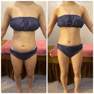 単発2回完了痩身！通常のお試しだと質量が少ないですが最初から仕上げるためしっかり行うボディ