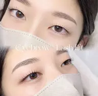 【🍍お得なセット🍍】美眉スタイリング＋お顔光脱毛（１回）