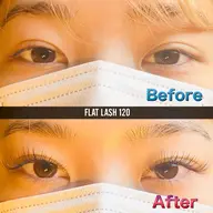 フラットラッシュ140本