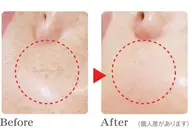 初回限定価格❣10分間当て放題✍目周りや片頬、部分が気になる方⭕シミが薄くなっていく導入化粧品でぷるつや仕上げ付き🥝