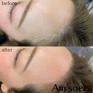 【フェイシャルワックス】角質・角栓・うぶ毛に💫ミニモ限定（通常7800円）