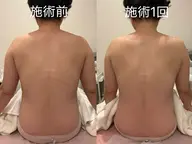 【デトックス痩身】リンパケア 60分(背面&デコルテ)