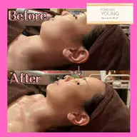 【クリスティーナ🧡フォーエバーヤング】❣️コルギ級の小顔・毛穴引き締め・リフトアップ✨通常¥24,200