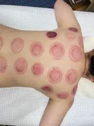 もみほぐし40分➕リンパマッサージ30分➕カッピング30分